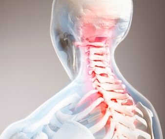 cervical spondylosis points