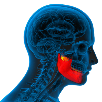 TMJ treatment jaw pain tonic physio