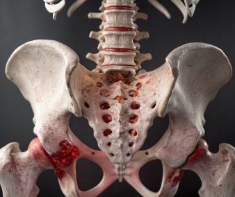 B-Pulse Pelvic Floor Strengthening POINTS