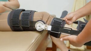 Custom Bracing vs Over-the-Counter Bracing at Tonic Physio in Milton Ontario