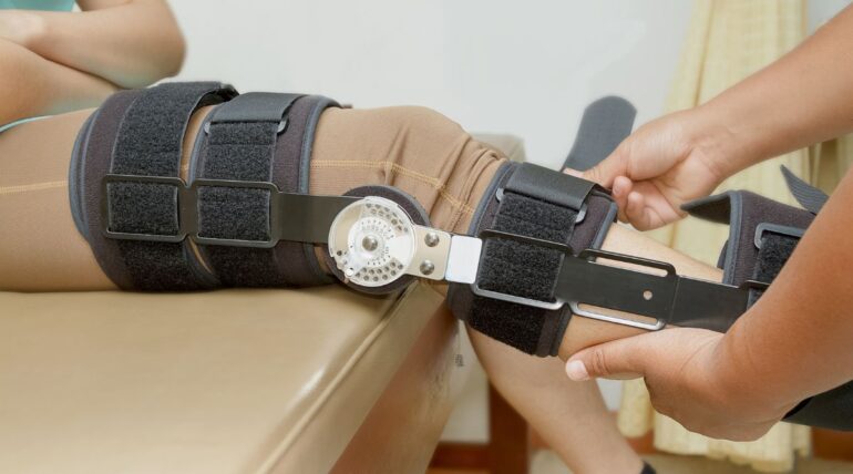 Custom Bracing vs Over-the-Counter Bracing at Tonic Physio in Milton Ontario