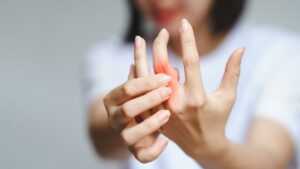 Rheumatoid-Arthritis-and-Physiotherapy-Management at Tonic Physio in Milton Ontario
