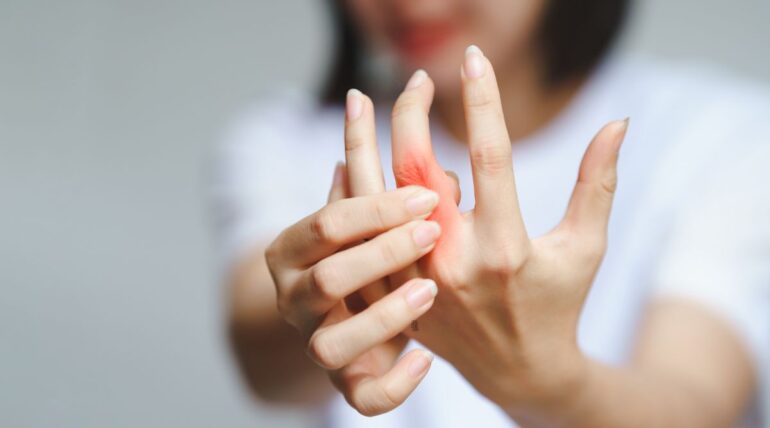 Rheumatoid-Arthritis-and-Physiotherapy-Management at Tonic Physio in Milton Ontario